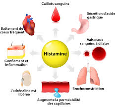 Histamine-intolérance